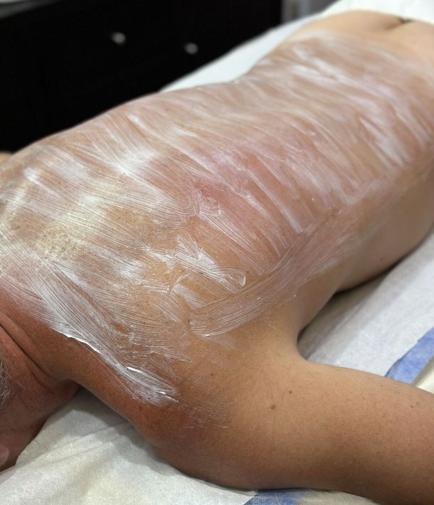 Depilación masculina en Valladolid