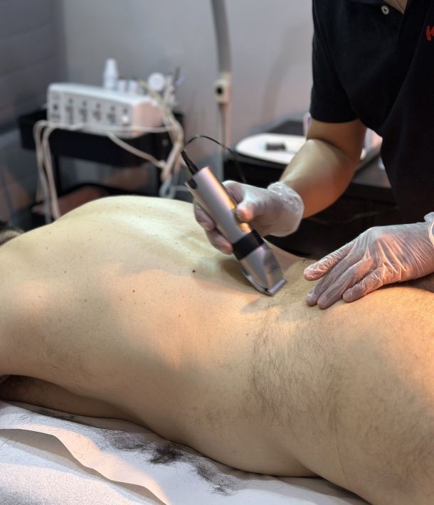 Trimming Corporal en Valladolid