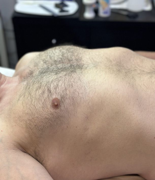 Trimming Corporal en Valladolid