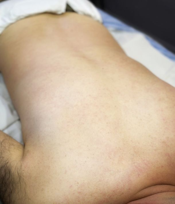 Depilación masculina en Valladolid