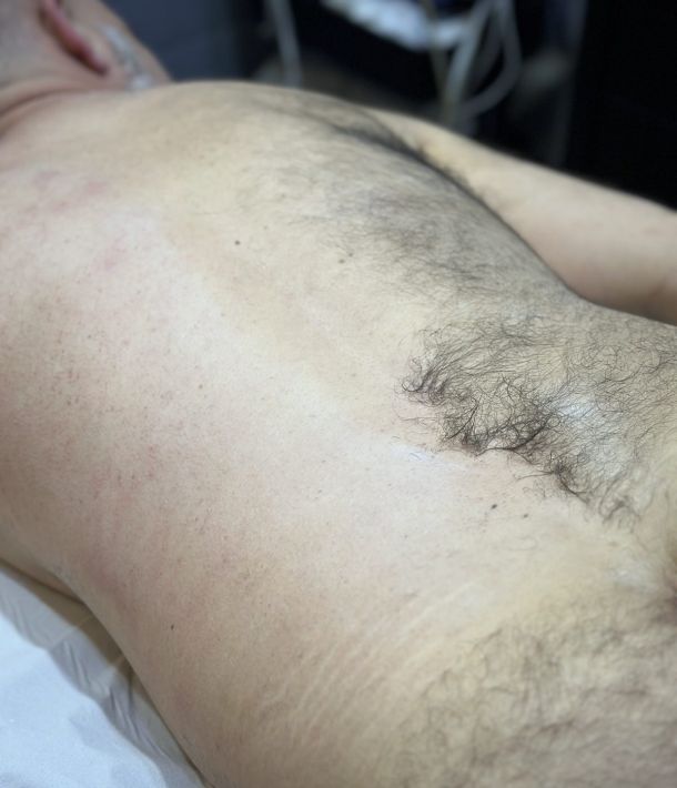 Depilación masculina en Valladolid